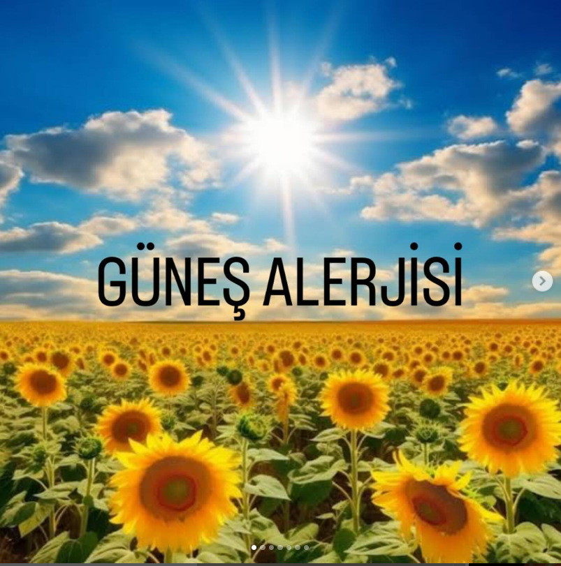 Güneş Alerjisi