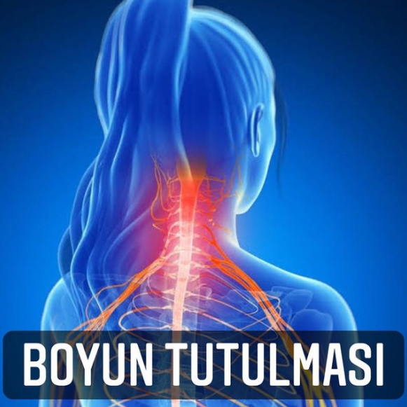 Boyun Tutulması